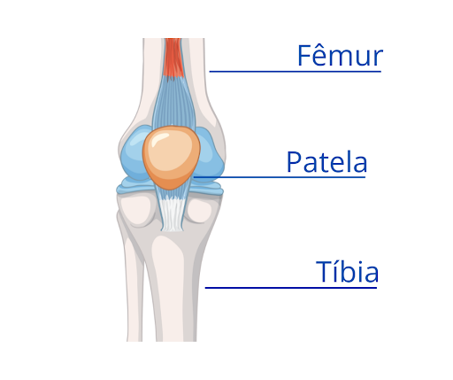 O cirurgião de joelho é o médico que trata a inflamação da patela